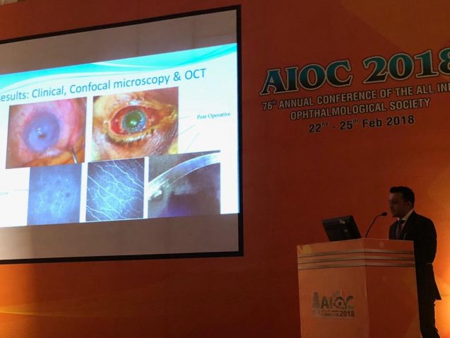 Breakthrough Work on Sural Nerve Grafting For Neurotrophic Keratopathy